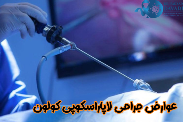 عوارض جراحی لاپاراسکوپی کولون