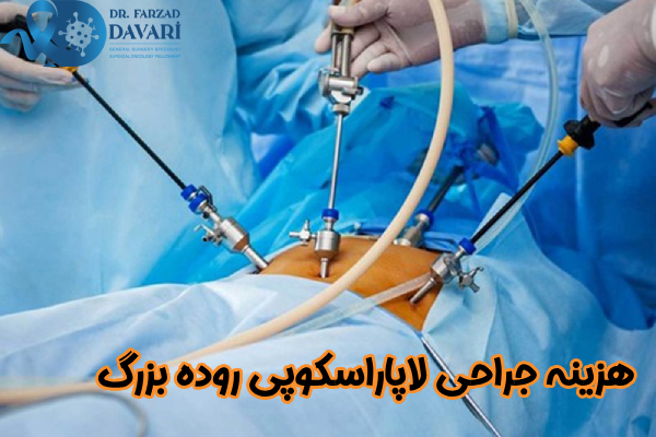 هزینه جراحی لاپاراسکوپی روده بزرگ