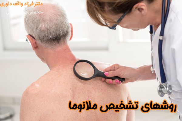 روشهای تشخیص ملانوما