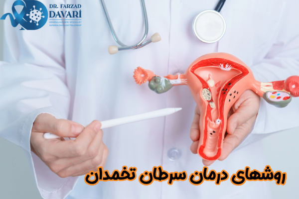 روشهای درمان سرطان تخمدان