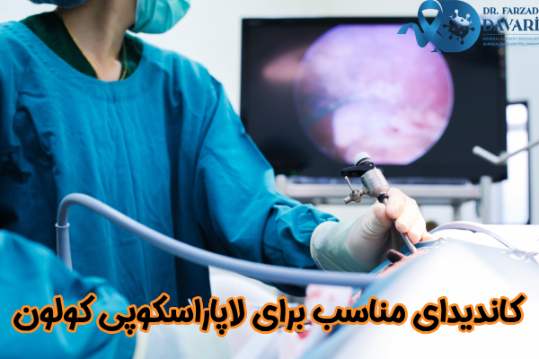 کاندیدای مناسب برای لاپاراسکوپی کولون