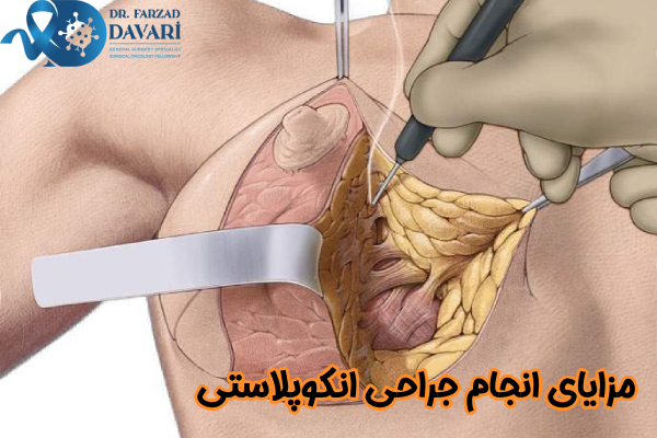 مزایای انجام جراحی انکوپلاستی