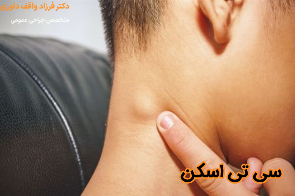 سی‌ تی اسکن برای سارکوم