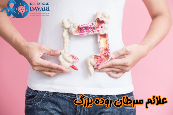 علائم سرطان روده بزرگ