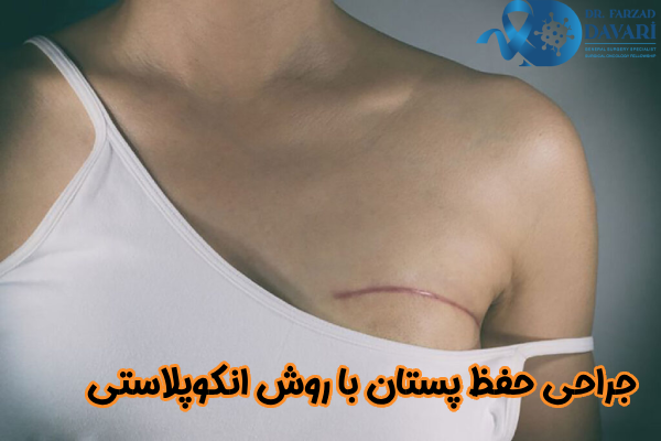 جراحی حفظ پستان با روش انکوپلاستی چیست