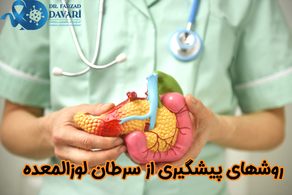 روشهای پیشگیری از سرطان لوزالمعده