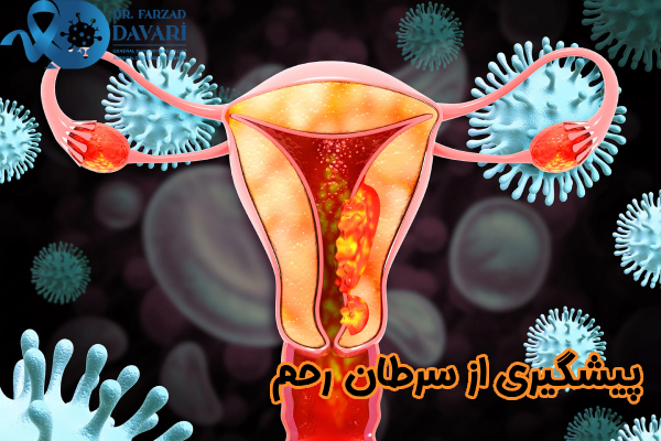 پیشگیری از سرطان رحم