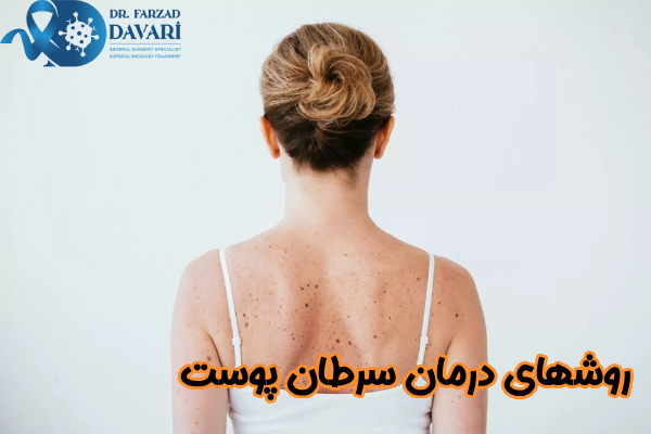 روشهای درمان سرطان پوست