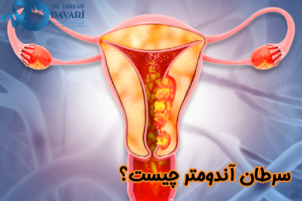 سرطان آندومتر چیست