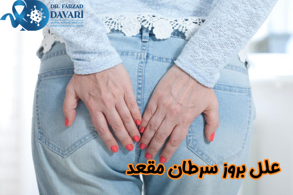 علل بروز سرطان مقعد