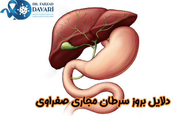 دلایل بروز سرطان مجاری صفراوی