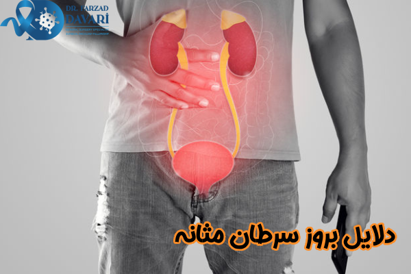 دلایل بروز سرطان مثانه