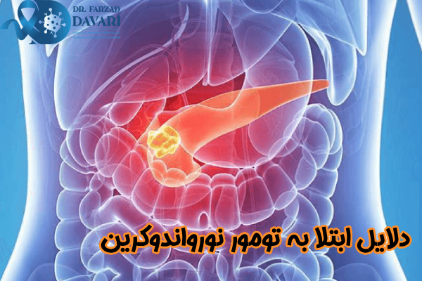 دلایل ابتلا به تومور نورواندوکرین