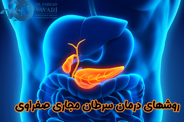 روشهای درمان سرطان مجاری صفراوی