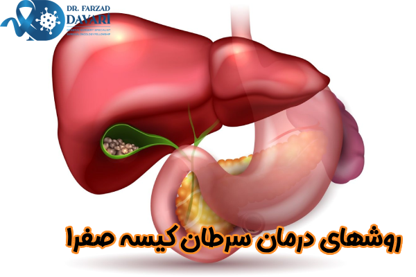 روشهای درمان سرطان کیسه صفرا