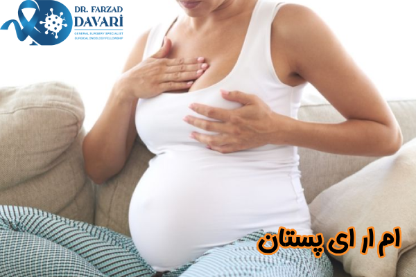 ام ار ای پستان
