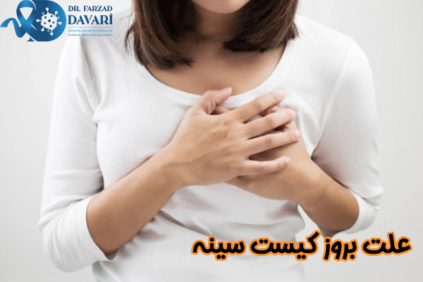 علت بروز کیست سینه