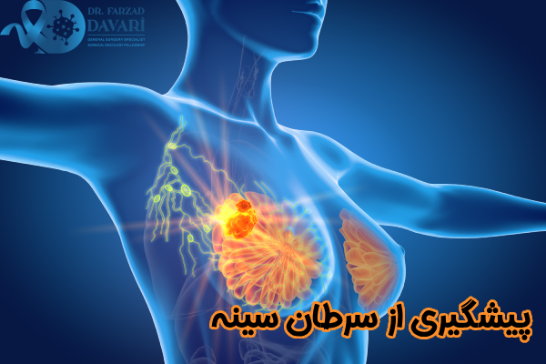 جلوگیری از سرطان سینه