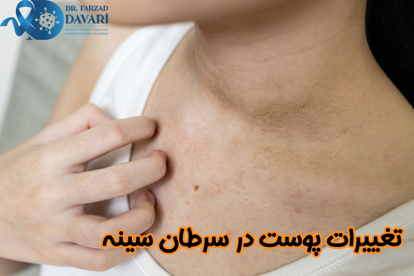 تغییرات پوستی و سرطان سینه