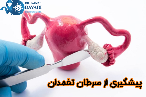پیشگیری از سرطان تخمدان چیست