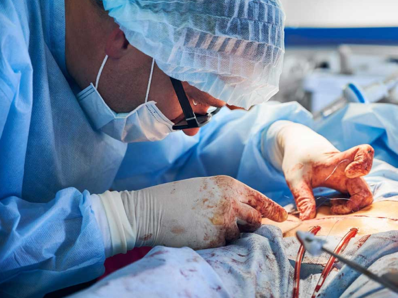 مراقبت های بعد از جراحی سرطان تخمدان