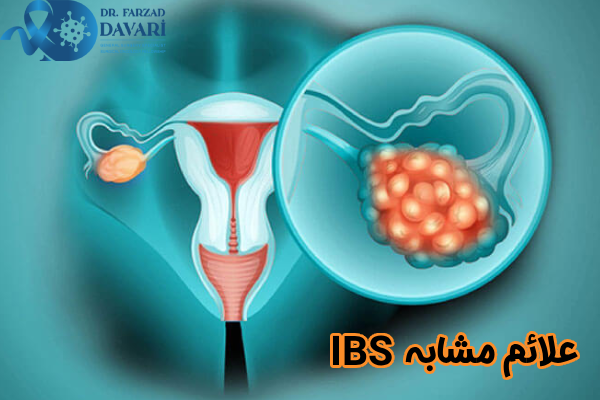 علائم مشابه IBS