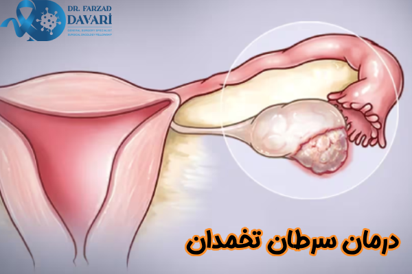 درمان سرطان تخمدان چیست