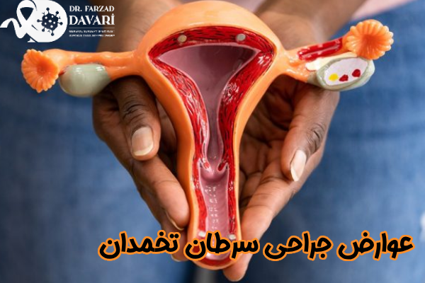 عوارض جراحی سرطان تخمدان