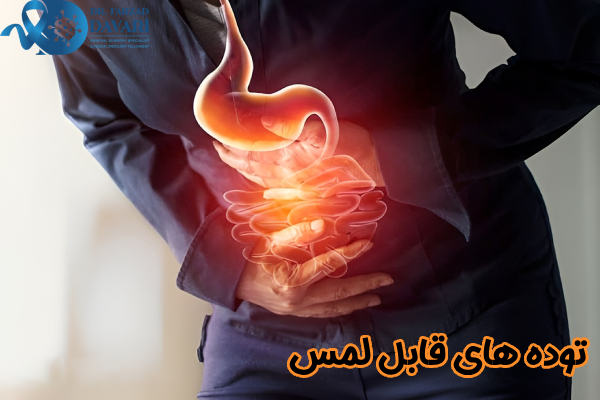 توده های قابل لمس