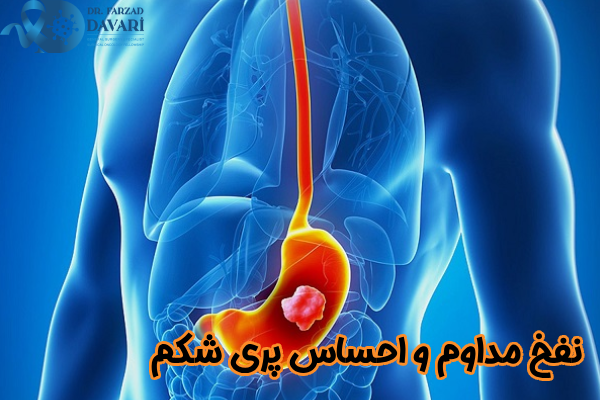 نفخ مداوم و احساس پری شکم