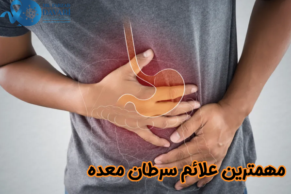 مهمترین علائم سرطان معده