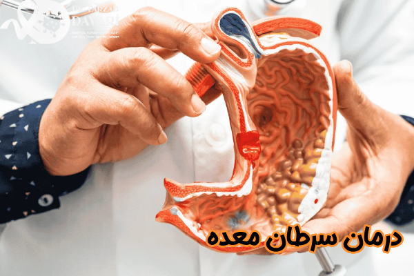درمان سرطان معده چیست