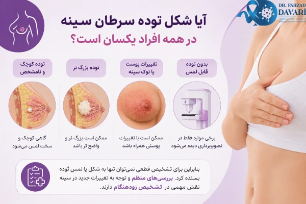 آیا شکل توده سرطان سینه یکسان است؟